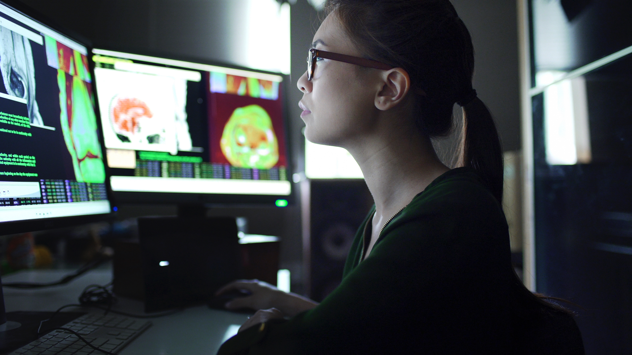 A woman looking at medical images on multiple computer monitors.